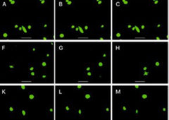 Clinical utility of circulating tumor‑associated cells to predict and monitor chemo‑response in solid tumors