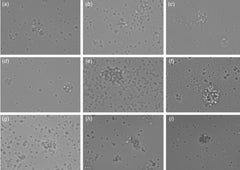 Circulating ensembles of tumor-associated cells: A redoubtable new systemic hallmark of cancer