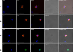 Evaluation of Circulating Tumor Cell Clusters for Pan-Cancer Noninvasive Diagnostic Triaging