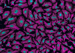 Hallmark Circulating Tumor-Associated Cell Clusters Signify 230 Times Higher One-Year Cancer Risk